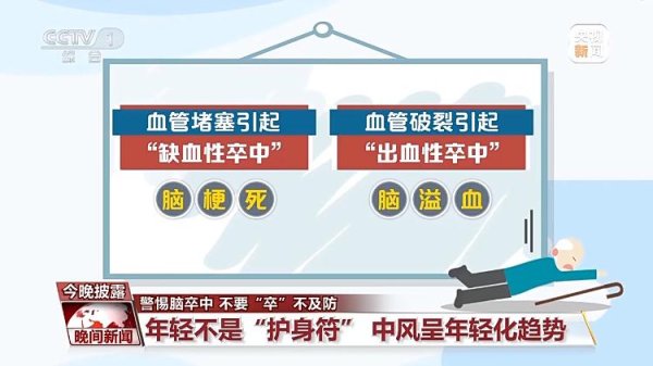 易盛通 中风“盯上”年轻人 判断急性脑卒中记住“120口诀”